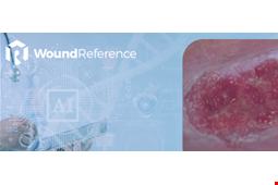 The Promise and Responsibility of AI in Wound Care: Enhancing Clinical Decision-Making